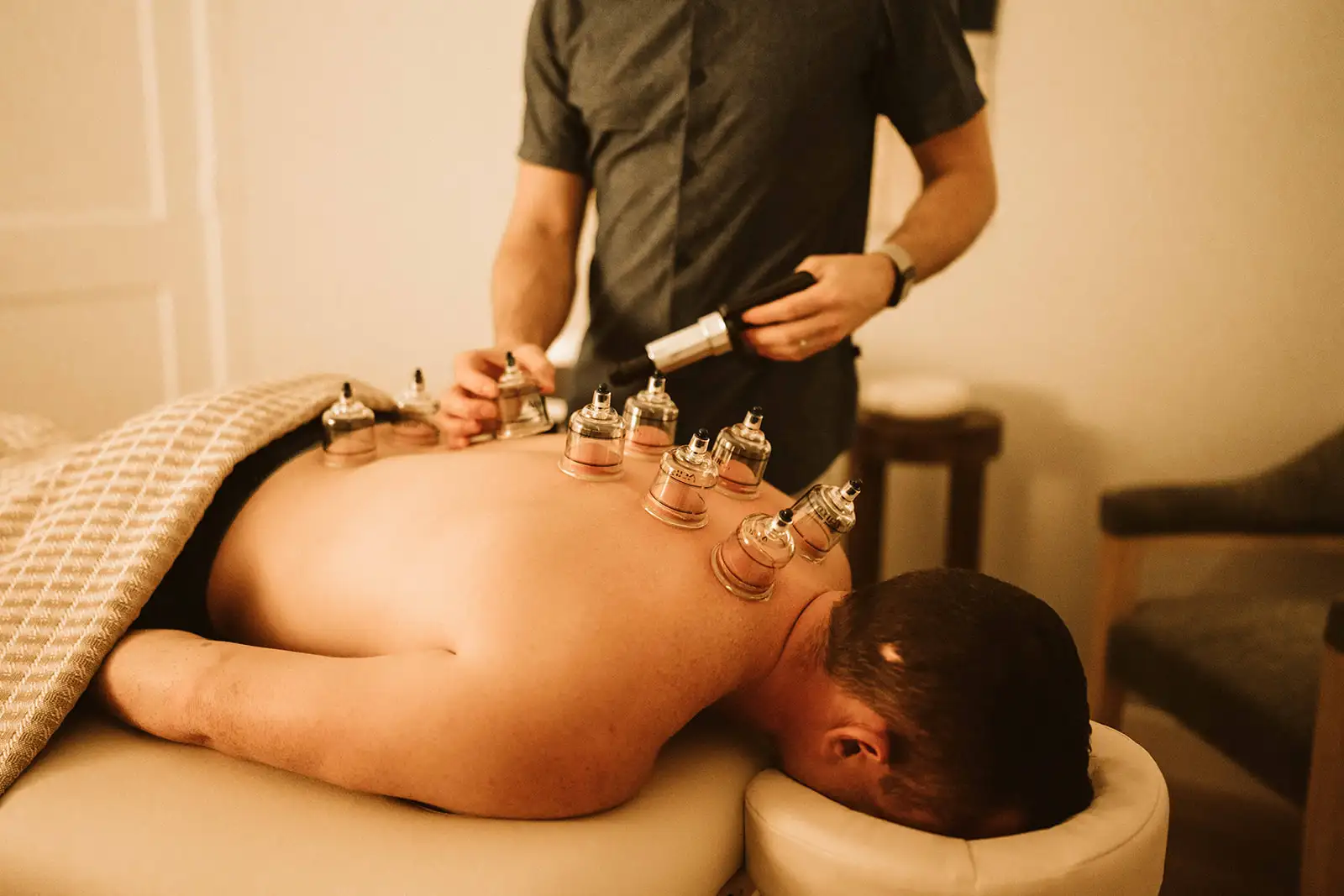 Cupping therapy applied to a patient’s back
